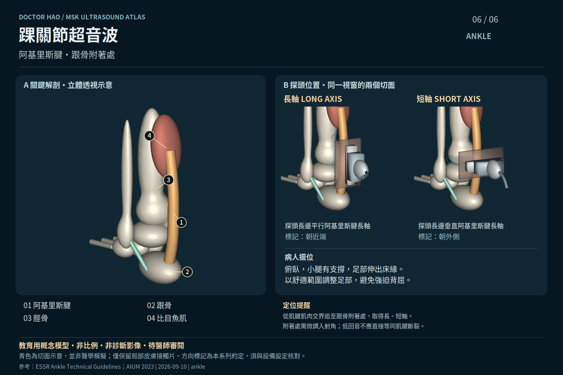 主模型為後外側概念視角,足部姿勢不是病人擺位指令;示範肌腱連續走向,不呈現合成超音波影像。