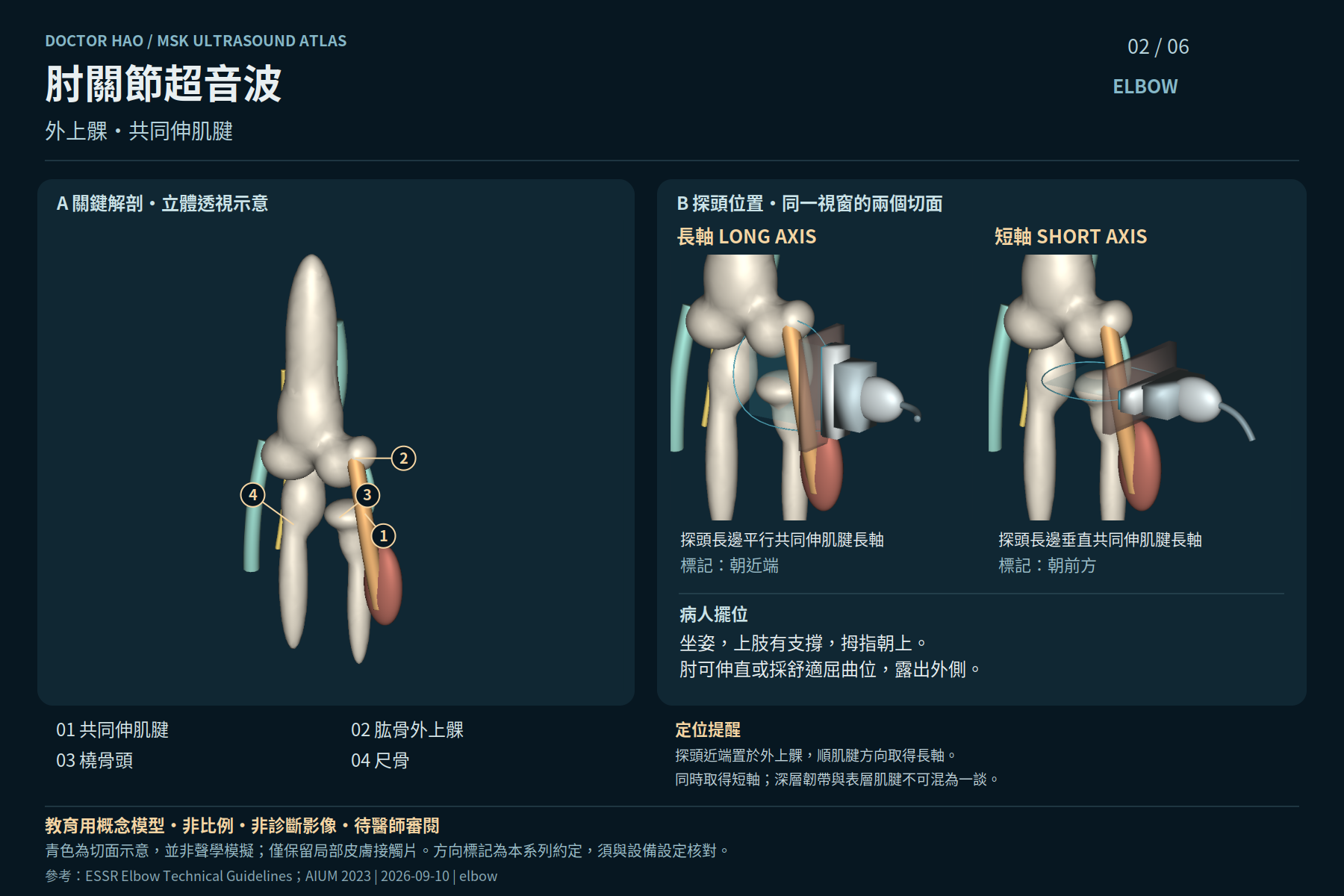 外上髁是共同伸肌腱的近端骨性地標;本視窗不取代前、內、後側的適應症導向評估。