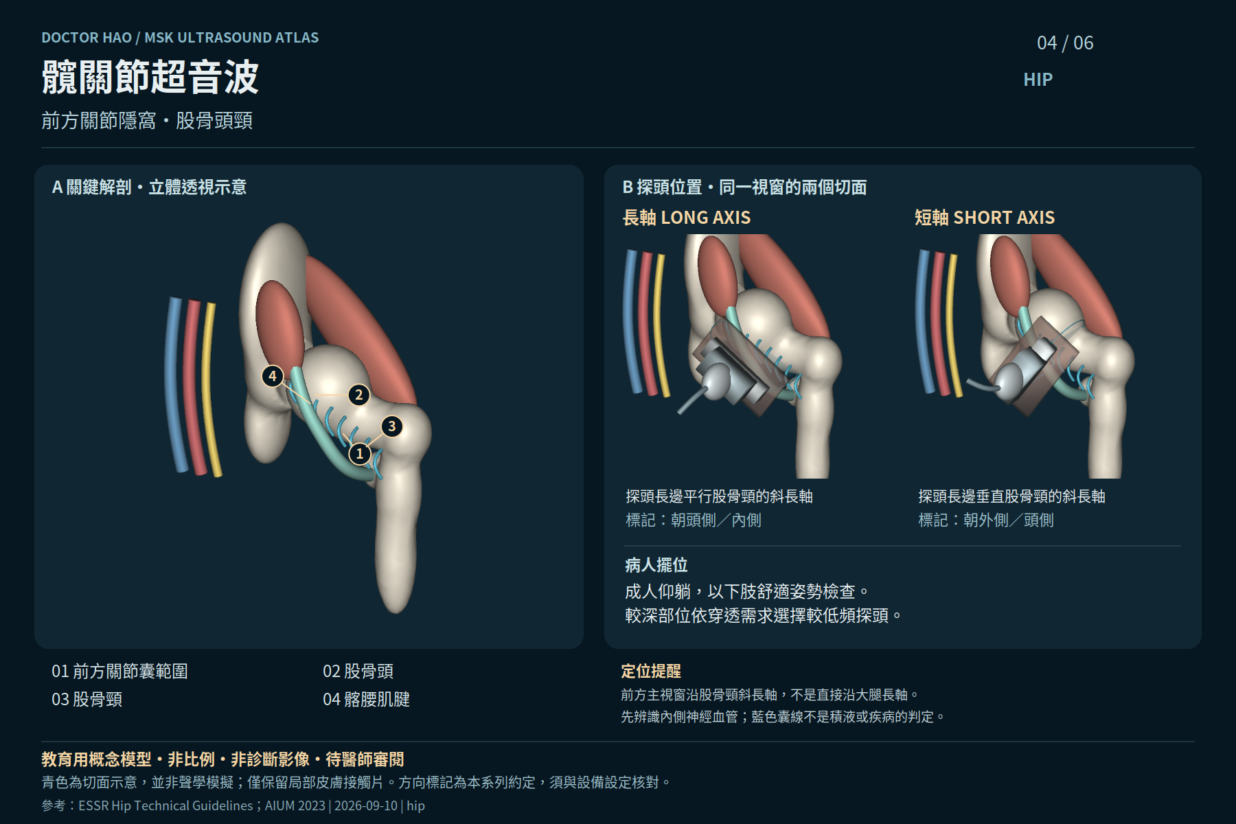 成人前髖示意;斜長軸以股骨頭、股骨頸定位。不是嬰兒髖發育評估,也不能據此排除盂唇病變。