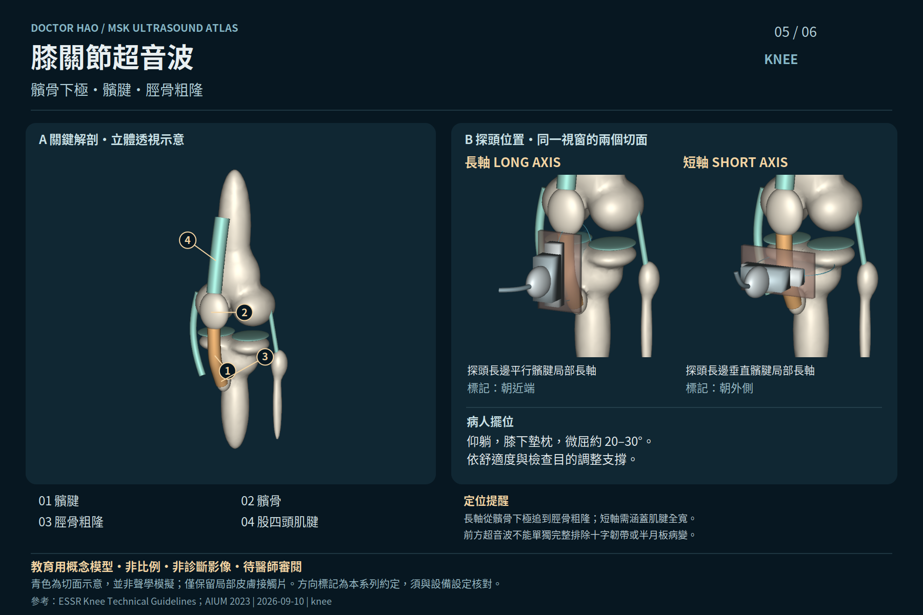 以髕腱為主要示範,髕骨未移開;骨形、軟組織厚度與間隙均為概念比例,不能量測或判讀病變。